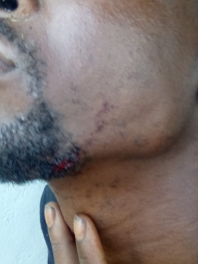 Man Beaten And Stabbed In Accompong Town Man Beaten And Stabbed In Accompong Town